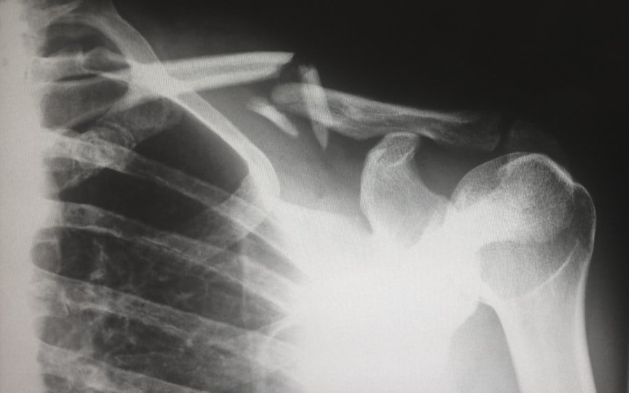 BS Medical Imaging Technology (BS MIT)